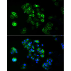 ABflo® 488 Rabbit anti-Human TROP-2 mAb