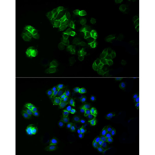 ABflo® 488 Rabbit anti-Human TROP-2 mAb
