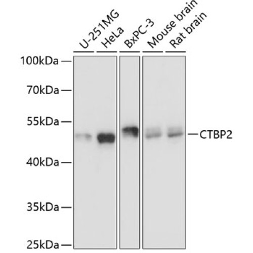CTBP2 Rabbit pAb