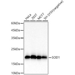 SOD1 Rabbit mAb