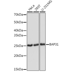 BAP31 Rabbit mAb