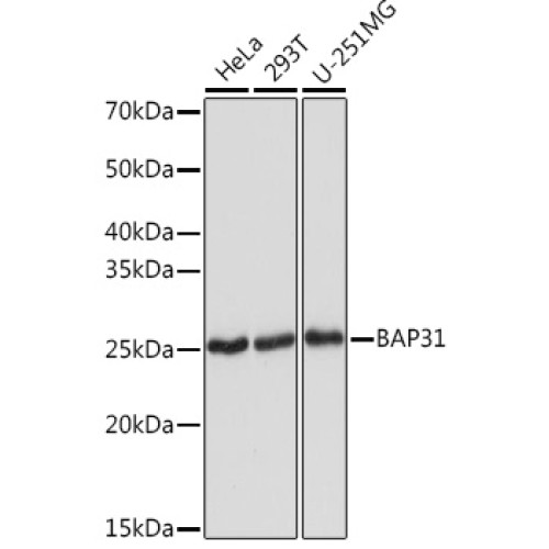 BAP31 Rabbit mAb