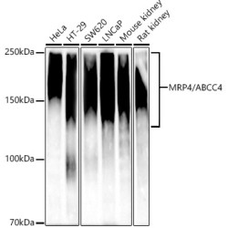 [KD Validated] MRP4/ABCC4 Rabbit mAb