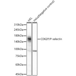 CD62P/P-selectin Rabbit mAb