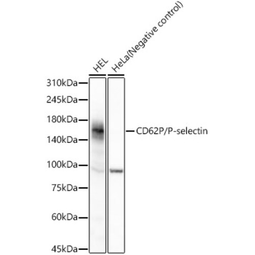 CD62P/P-selectin Rabbit mAb