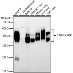 CAR/CXADR Rabbit mAb