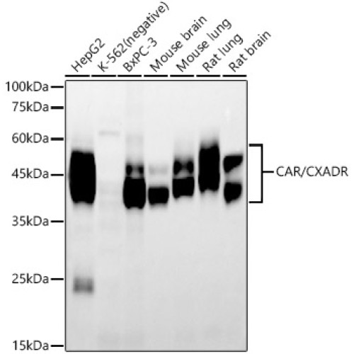 CAR/CXADR Rabbit mAb