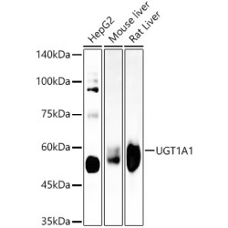 UGT1A1 Rabbit mAb