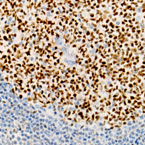 BCL6 Rabbit mAb