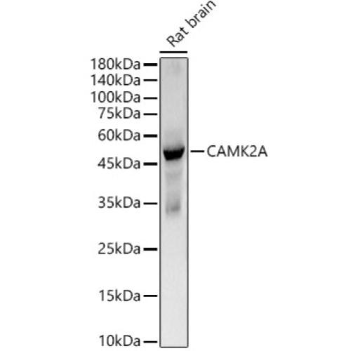 CAMK2A Rabbit mAb
