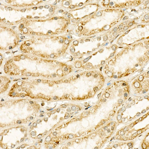 CYP24A1 Rabbit mAb