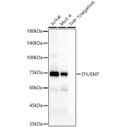 ITK/EMT Rabbit mAb