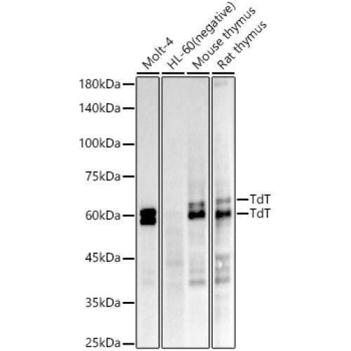 TdT Rabbit mAb