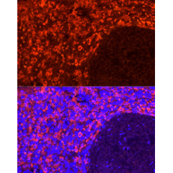 CD163 Rabbit mAb