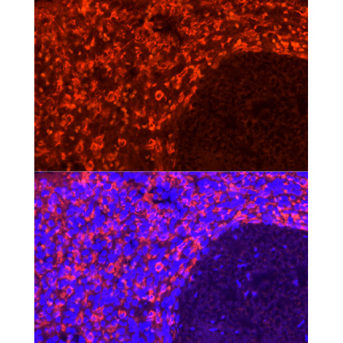 CD163 Rabbit mAb