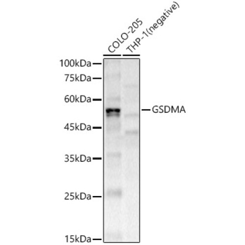 GSDMA Rabbit mAb