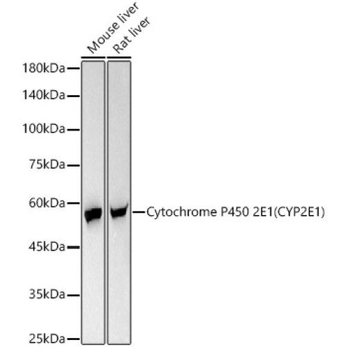 Cytochrome P450 2E1 (CYP2E1) Rabbit mAb
