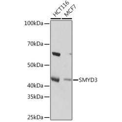 SMYD3 Rabbit mAb