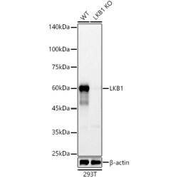 [KO Validated] LKB1 Rabbit mAb