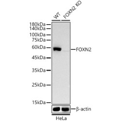 [KO Validated] FOXN2 Rabbit mAb