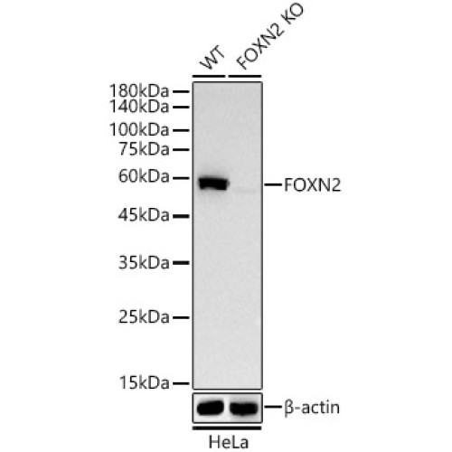 [KO Validated] FOXN2 Rabbit mAb