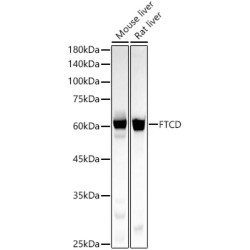 FTCD Rabbit mAb