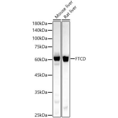 FTCD Rabbit mAb