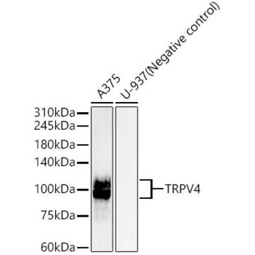 TRPV4 Rabbit mAb