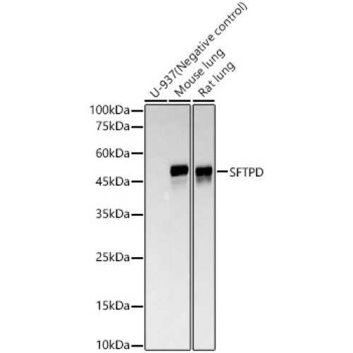 SFTPD Rabbit mAb