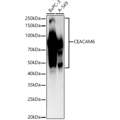 CEACAM6 Rabbit mAb