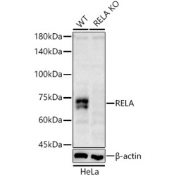 [KO Validated] RELA Rabbit pAb