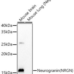 Neurogranin (NRGN) Rabbit mAb