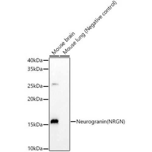 Neurogranin (NRGN) Rabbit mAb