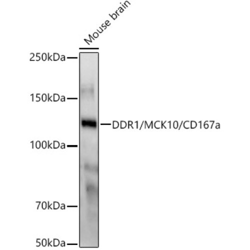 DDR1/MCK10/CD167a Rabbit mAb