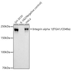 Integrin alpha 1 (ITGA1/CD49a) Rabbit mAb