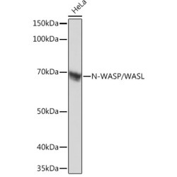 N-WASP/WASL Rabbit mAb
