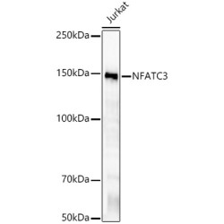 NFATC3 Rabbit mAb