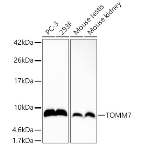 TOMM7 Rabbit mAb