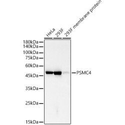 PSMC4 Rabbit mAb