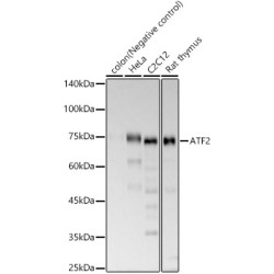 ATF2 Rabbit mAb