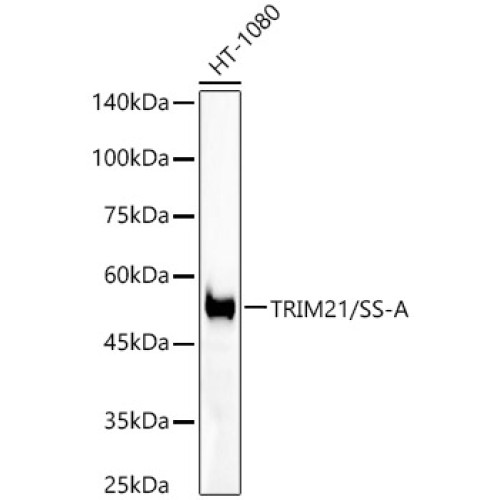 [KO Validated] TRIM21/SS-A Rabbit mAb