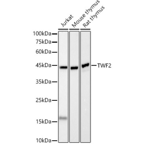TWF2 Rabbit mAb