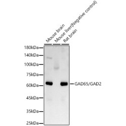 GAD65/GAD2 Rabbit mAb