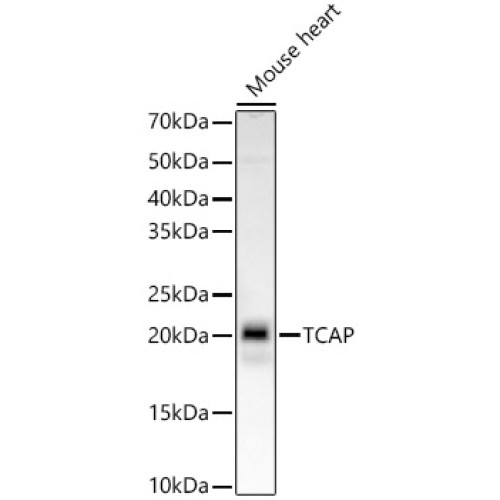 TCAP Rabbit mAb