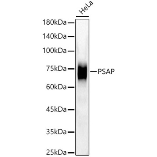 [KD Validated] PSAP Rabbit mAb