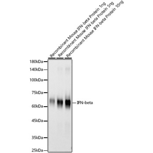 IFN-beta Rabbit mAb