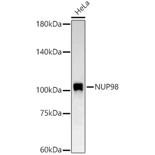 NUP98 Rabbit mAb
