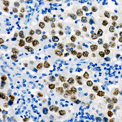 Sall4 Rabbit mAb