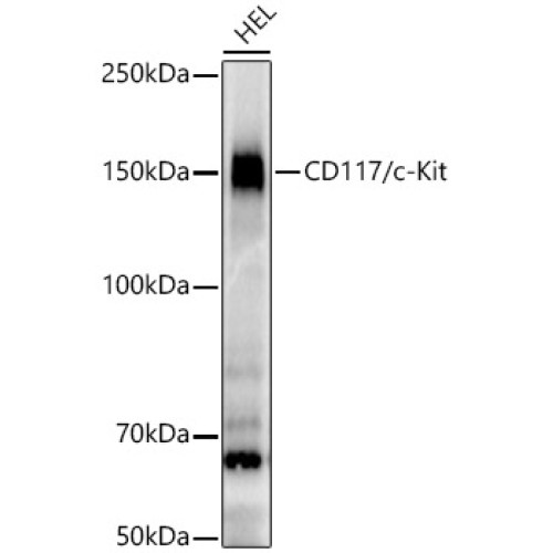 CD117/c-Kit Rabbit mAb