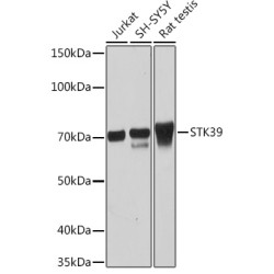 STK39 Rabbit mAb